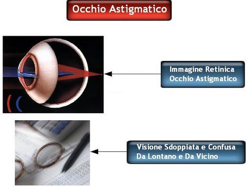 L'occhio astigmatico percepisce immagini sfocate e imprecise a tutte le distanze